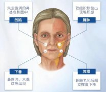 皮肤松弛了怎么办?紧肤除皱,6个妙计分享! 皮肤松弛了怎么办?紧肤除皱,6个妙计分享!