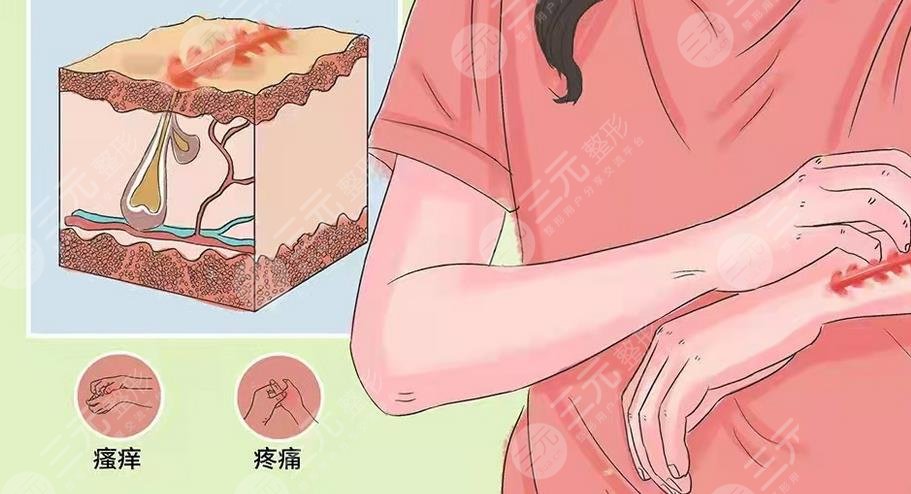 陈再洪医生疤痕切除手术案例