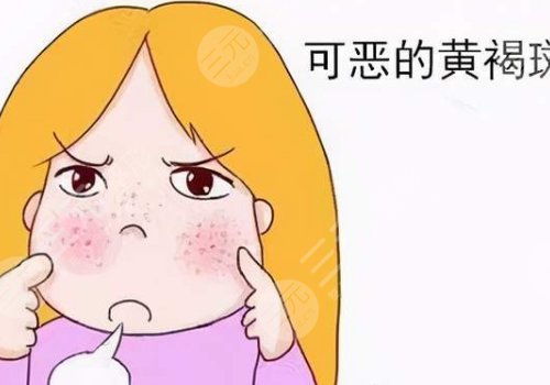 激光祛斑会不会反弹？