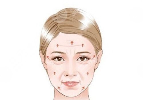 广州可玉医疗美容做光子好吗?