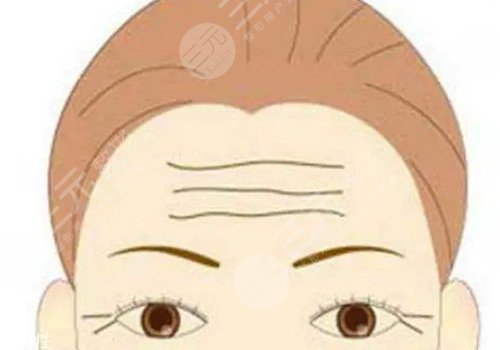 广州可玉医疗美容做光子好吗?