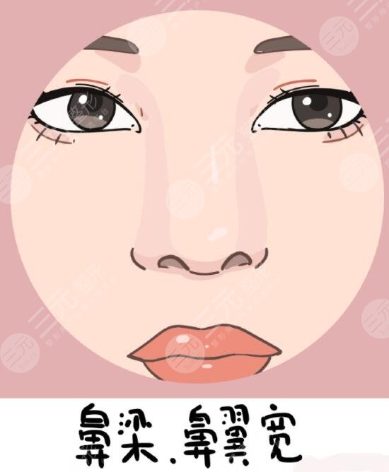 玻尿酸隆鼻的价格受到了哪些因素影响?