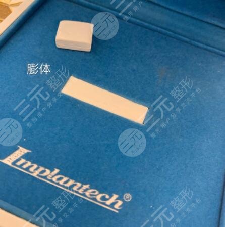 膨体隆鼻预防感染注意事项有哪些?