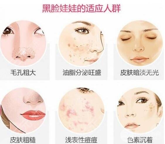 什么是黑脸娃娃缓解?