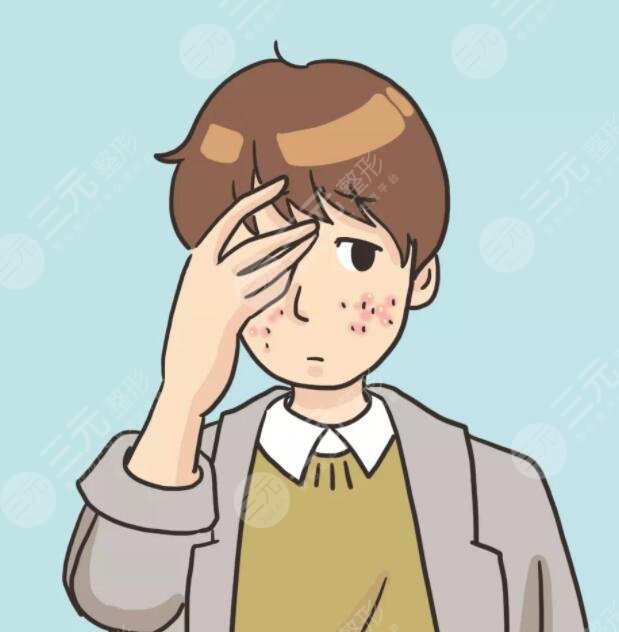 男生祛痘的小窍门是什么？做好这5点可以大大缓解痘肌！