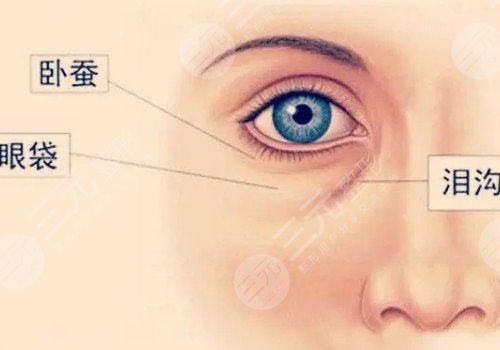 注射卧蚕有什么风险？