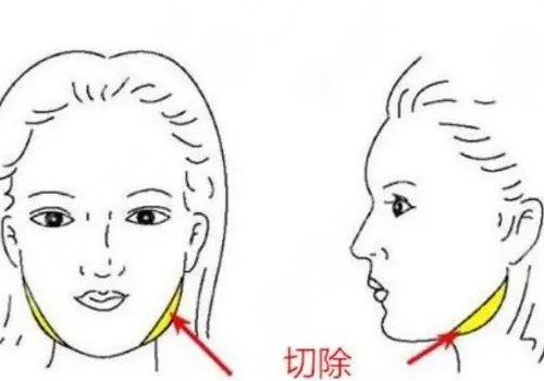 上海时光整形颌面好不好?