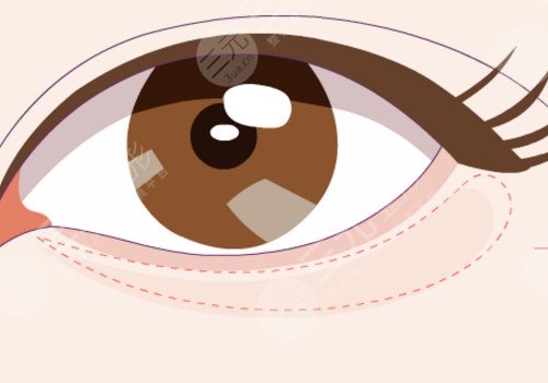 注射卧蚕多久恢复自然?