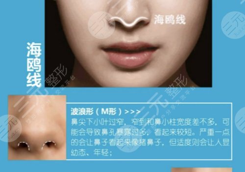 海鸥线和鹰钩鼻的区别