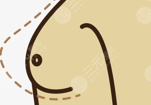 隆胸乳晕切口的优缺点