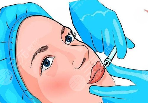 唇部注射玻尿酸多久可以恢复?