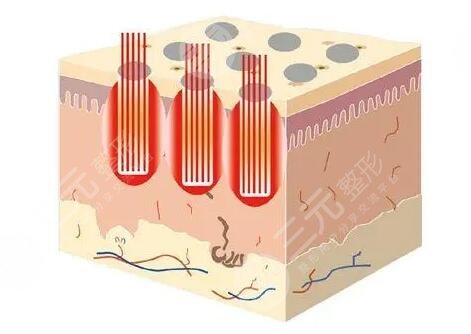 点阵像素激光是什么效果?