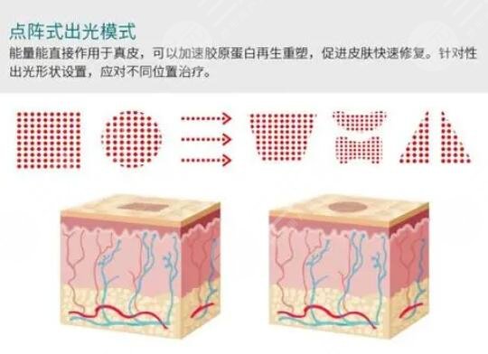 点阵像素激光是什么效果?