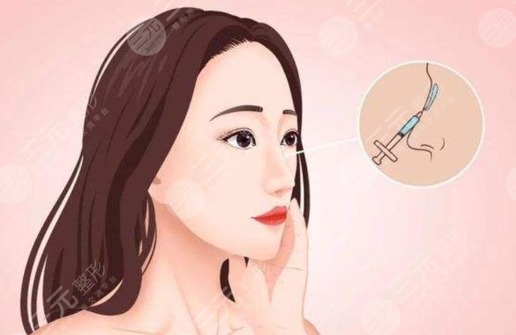 玻尿酸隆鼻有副作用吗