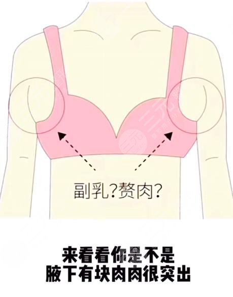 6大腋下副乳运动消除方法！4分钟消除副乳！甩掉拜拜肉！