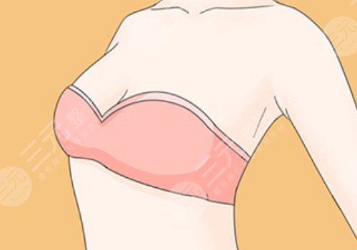 隆胸腋下切口的优势和缺点有哪些？