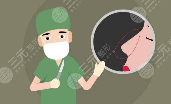 硅胶隆鼻前后对比效果差距明显，直男看了都直呼‘侧颜杀手’