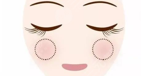 苹果肌