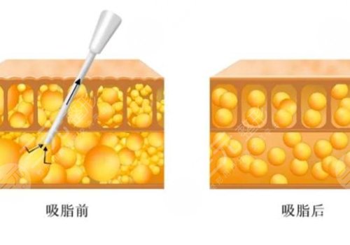 郑州丽天罗明生医生怎么样?