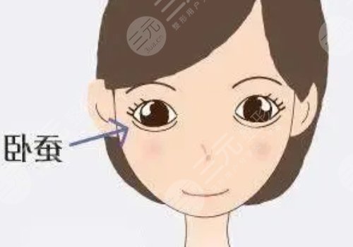 注射卧蚕后会变成眼袋吗？