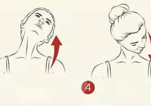 天鹅颈和普通脖子有啥区别？