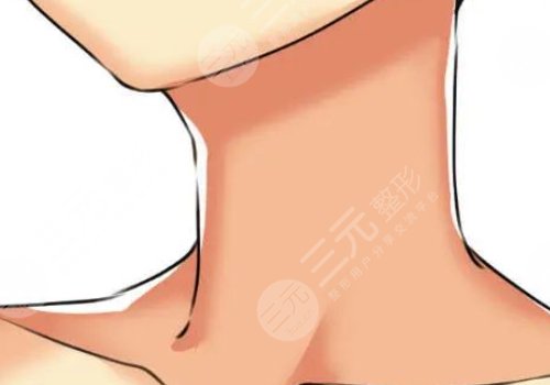 天鹅颈和普通脖子有啥区别？