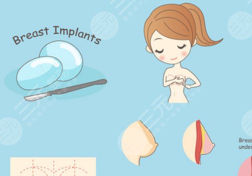 假体丰胸如何避免包膜痉挛？