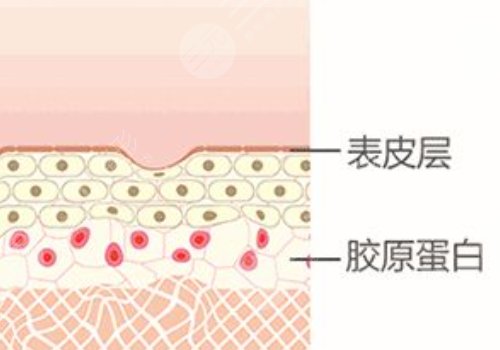 热玛吉成都授权机构有哪些?