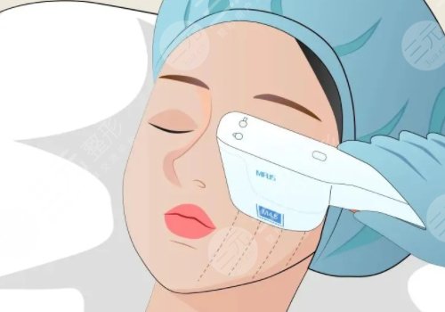 热玛吉成都授权机构有哪些?