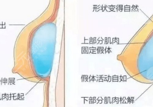 法国伊思雅和美国曼托那个好？