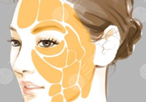 面部脂肪填充的好处和坏处有哪些