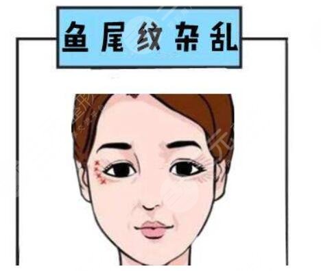祛除鱼尾纹的注意事项