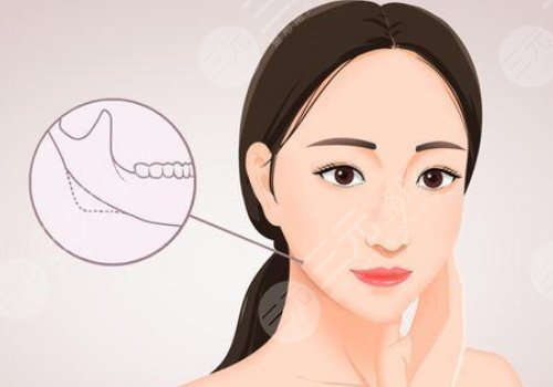 轮廓整形1个月和6个月对比图