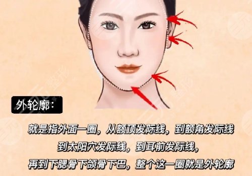 轮廓整形1个月和6个月对比图