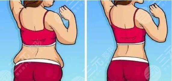 瘦腰丰胸运动有用吗？常见的安全可靠的丰胸运动盘点！