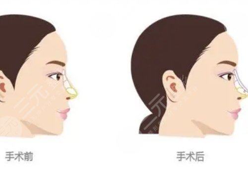 成都天之美的刘宁医生怎么样?