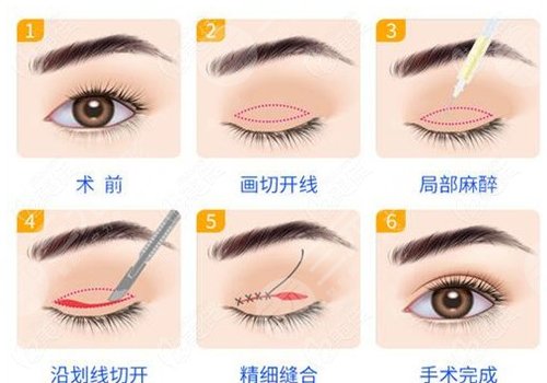 成都天之美的刘宁医生怎么样?