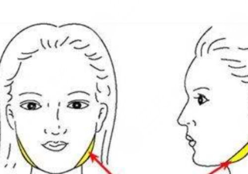 国字脸削骨手术一般多少钱？