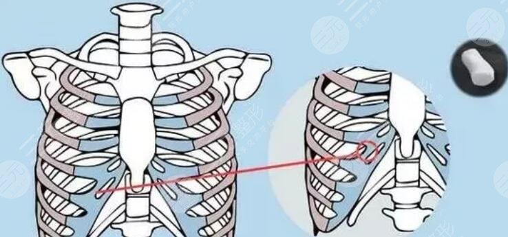 宁波郭光烨医生擅长项目