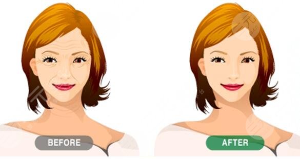 柳民熙医生擅长项目