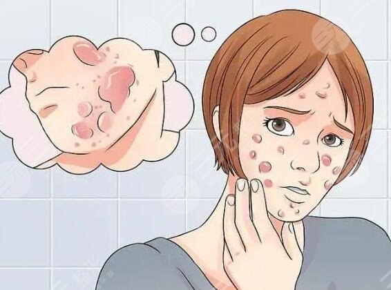 去痘印要多少钱一次？痘坑能修复吗？怎么预防痘印？