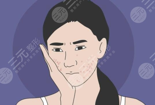 去痘印要多少钱一次?