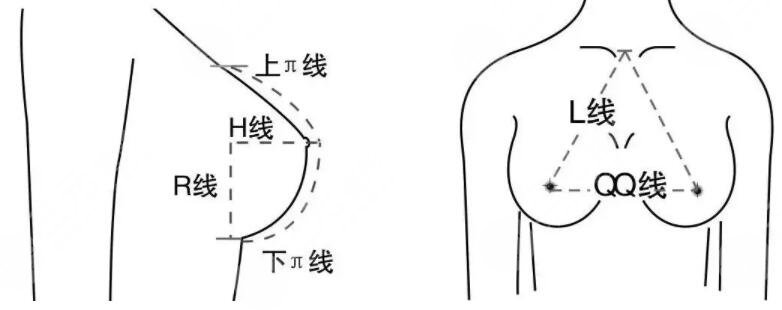 新桥医院樊东力假体隆胸案例