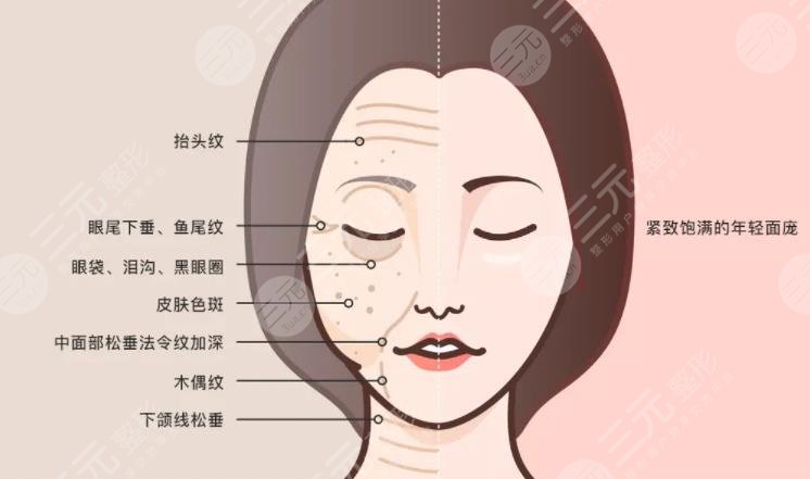 面部提升