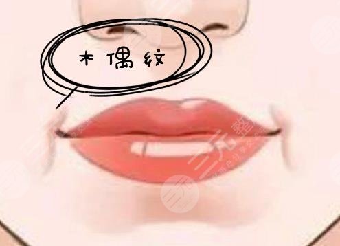 木偶纹去除
