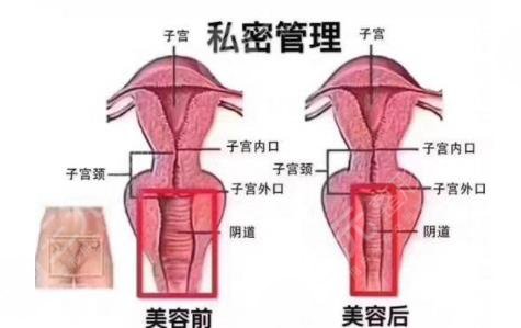 私密整形