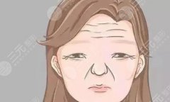 上面部动态纹主要包含哪些皱纹类型?包括了鱼尾纹、抬头纹、皱眉纹等 上面部动态纹主要包含哪些皱纹类型?包括了鱼尾纹、抬头纹、皱眉纹等