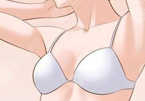 光面假体容易包膜挛缩吗？会移位吗？