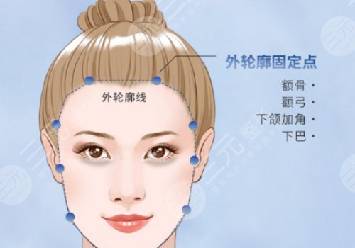 玻尿酸轮廓固定提升能保持多久？