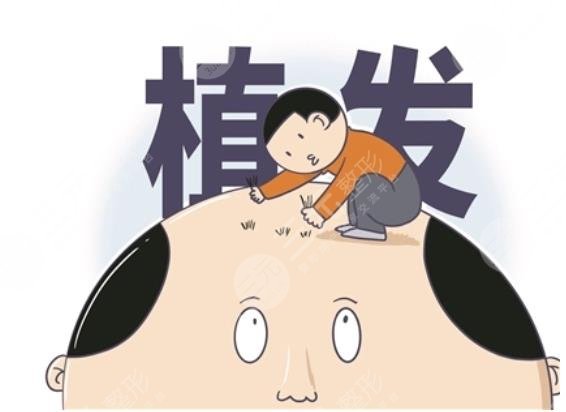 种一根头发需要多少钱